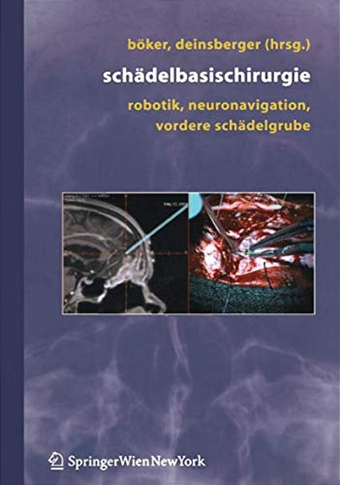 Schädelbasischirurgie: Robotik, Neuronavigation, Vordere Schädelgrube-..