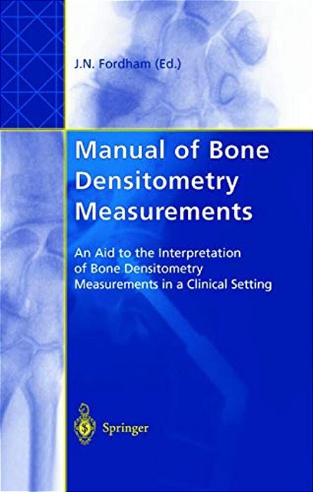 Manual Of Bone Densitometry Measurements: An Aid To The Interpretation Of Bone Densitometry Measurements In A Clinical Setting-..