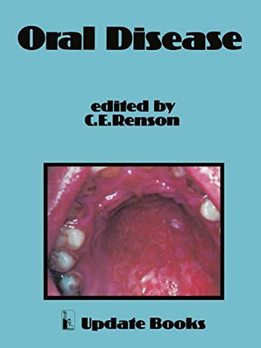 Oral Disease-..