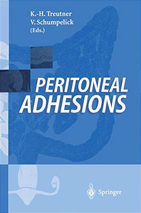 Peritoneal Adhesions-..