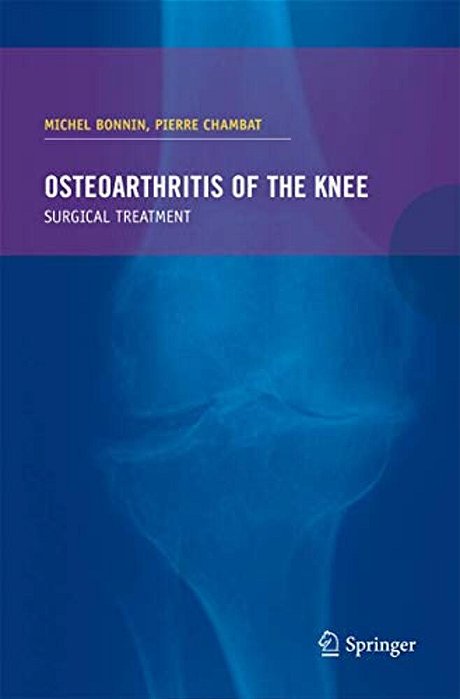 Osteoarthritis Of The Knee-..