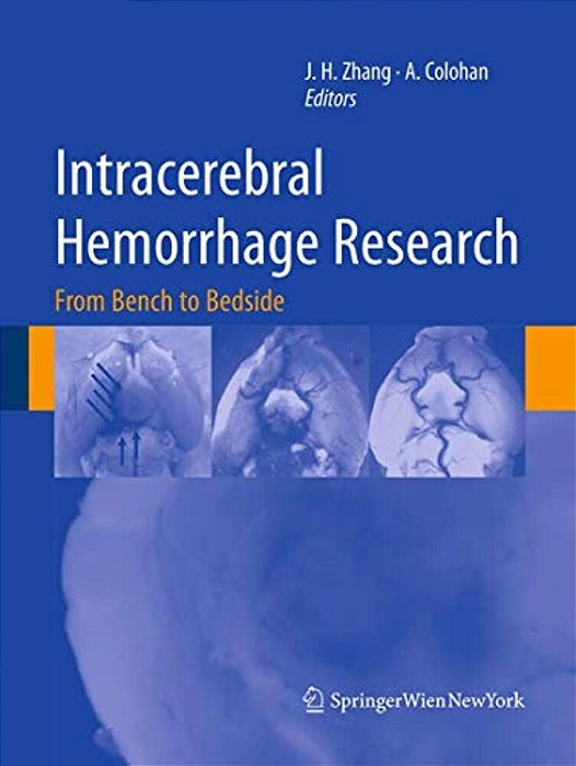 Intracerebral Hemorrhage Research: From Bench To Bedside-..
