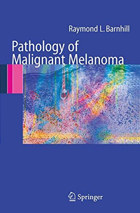 Pathology Of Malignant Melanoma-..