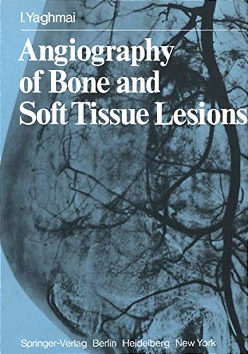 Angiography Of Bone And Soft Tissue Lesions-..