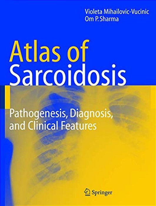 Atlas Of Sarcoidosis: Pathogenesis, Diagnosis And Clinical Features-..