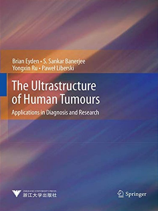 The Ultrastructure Of Human Tumours: Applications In Diagnosis And Research-..
