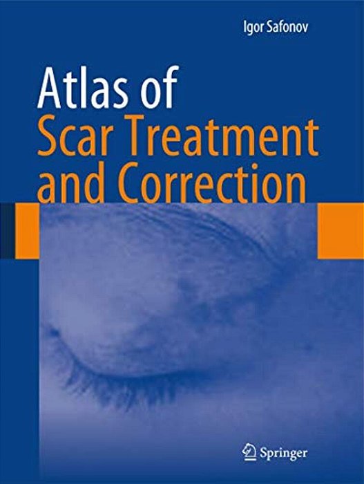 Atlas Of Scar Treatment And Correction-..