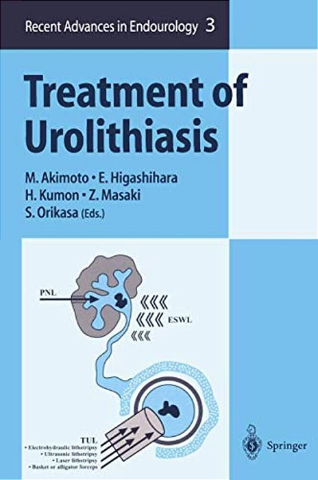 Treatment Of Urolithiasis-..