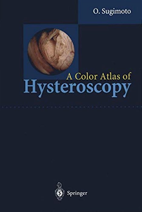 A Color Atlas Of Hysteroscopy-..