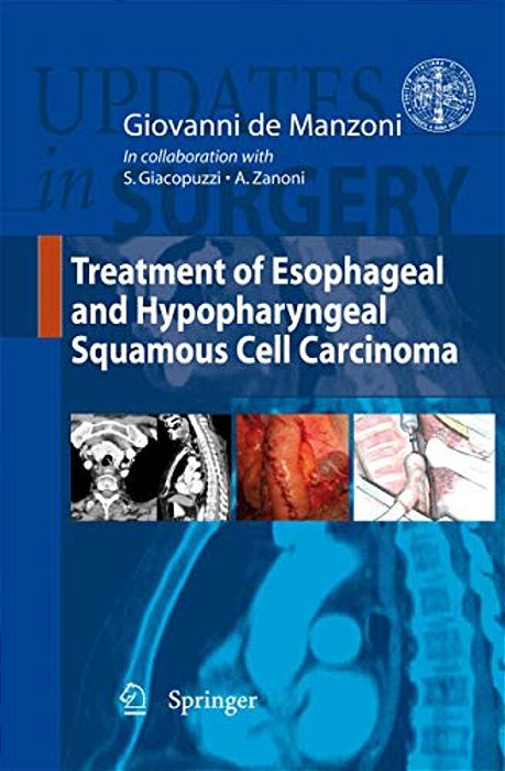 Treatment Of Esophageal And Hypopharyngeal Squamous Cell Carcinoma-..