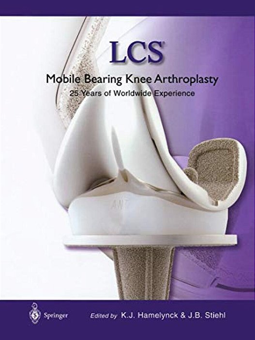 Lcs(r) Mobile Bearing Knee Arthroplasty: A 25 Years Worldwide Review-..