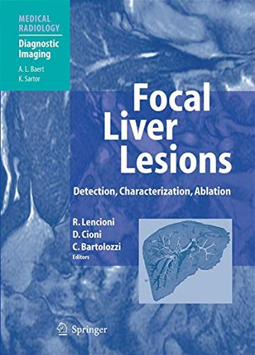 Focal Liver Lesions: Detection, Characterization, Ablation-..