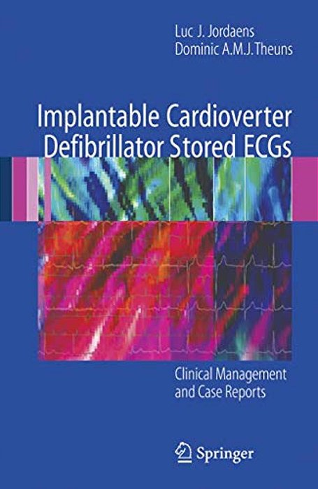 Implantable Cardioverter Defibrillator Stored Ecgs: Clinical Management And Case Reports-..