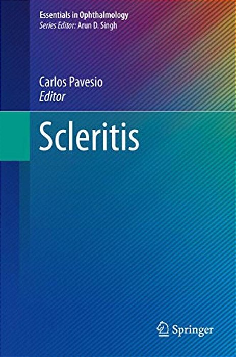 Scleritis-..