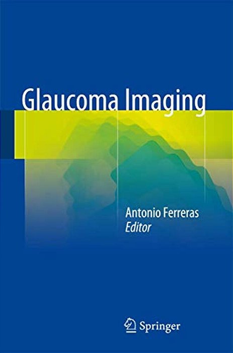 Glaucoma Imaging-..