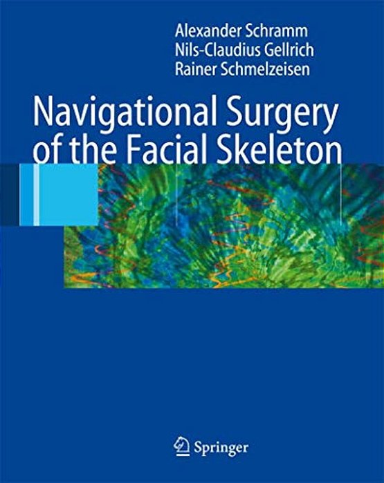Navigational Surgery Of The Facial Skeleton-..