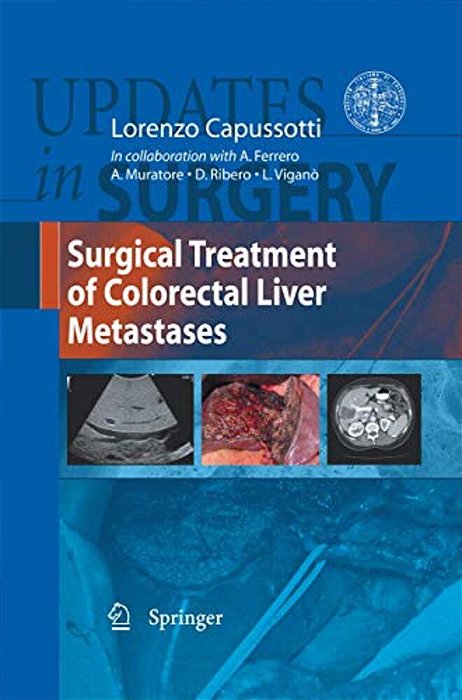Surgical Treatment Of Colorectal Liver Metastases-..