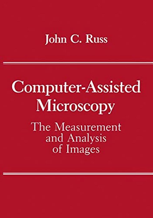 Computer-Assisted Microscopy: The Measurement And Analysis Of Images-..