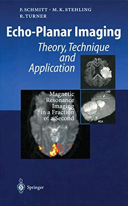 Echo-Planar Imaging: Theory, Technique And Application-..