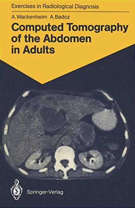 Computed Tomography Of The Abdomen In Adults: 85 Radiological Exercises For Students And Practitioners-..