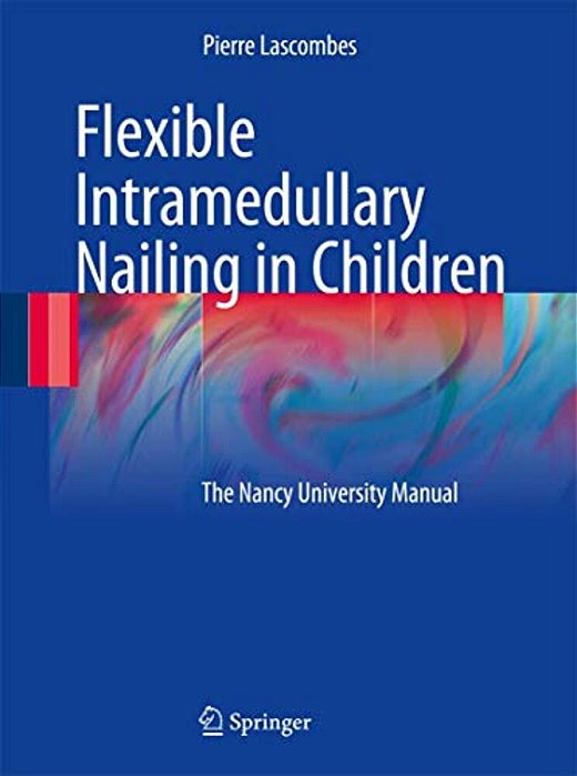 Flexible Intramedullary Nailing In Children: The Nancy University Manual-..