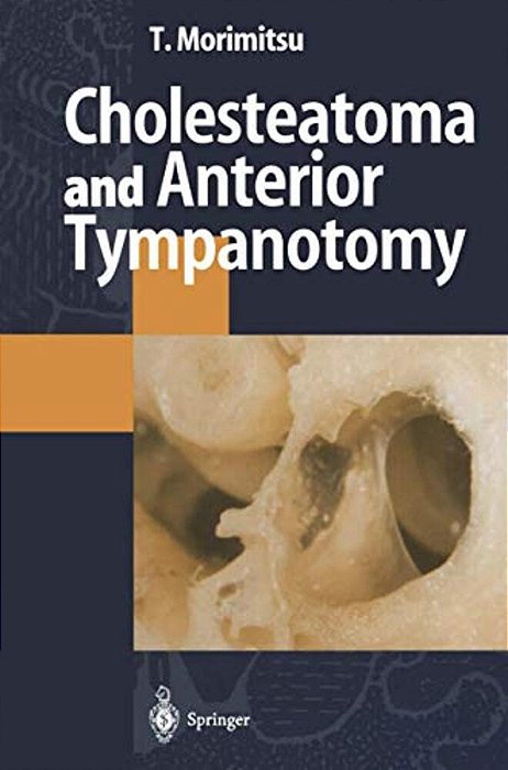 Cholesteatoma And Anterior Tympanotomy-..
