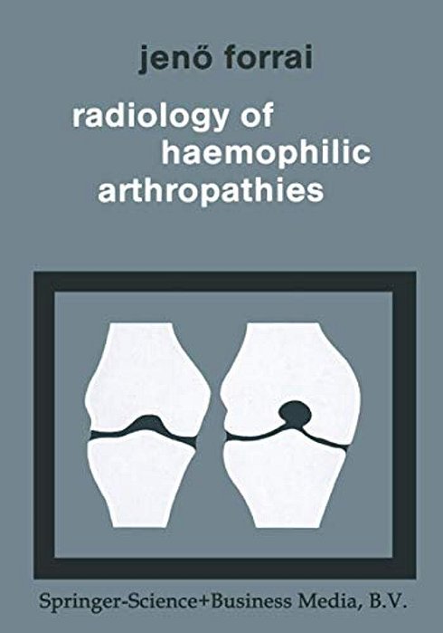 Radiology Of Haemophilic Arthropathies-..