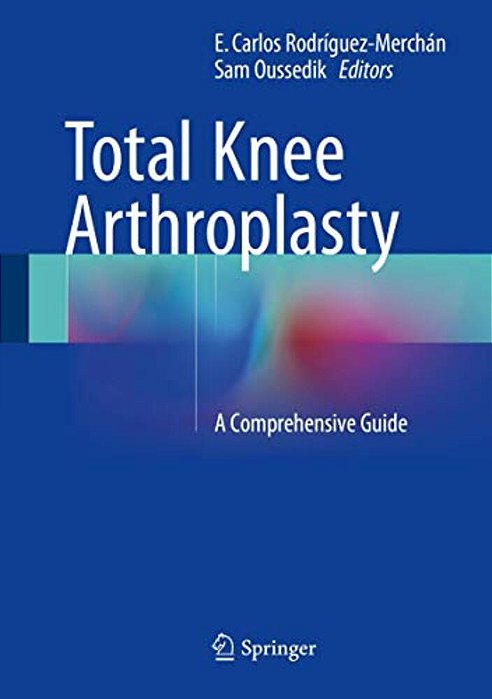 Total Knee Arthroplasty: A Comprehensive Guide-..