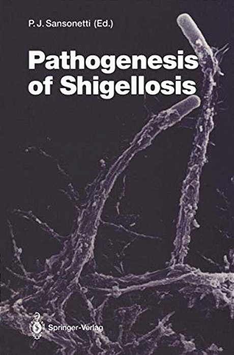 Pathogenesis Of Shigellosis-..