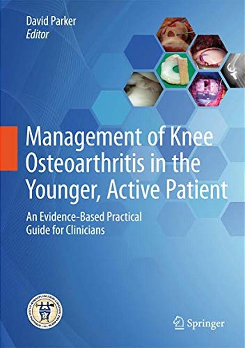 Management Of Knee Osteoarthritis In The Younger, Active Patient: An Evidence-Based Practical Guide For Clinicians-..