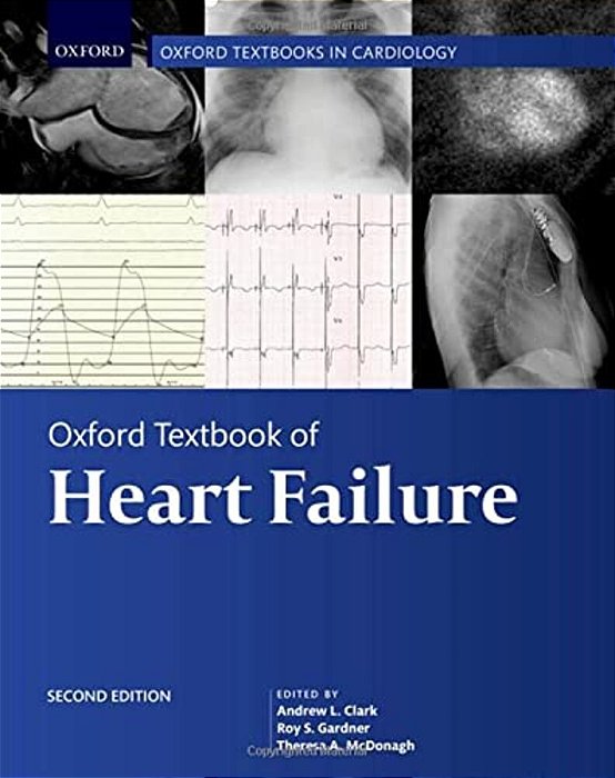 Oxford Textbook Of Heart Failure-..
