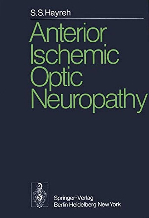 Anterior Ischemic Optic Neuropathy-..