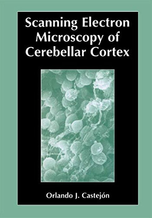 Scanning Electron Microscopy Of Cerebellar Cortex-..