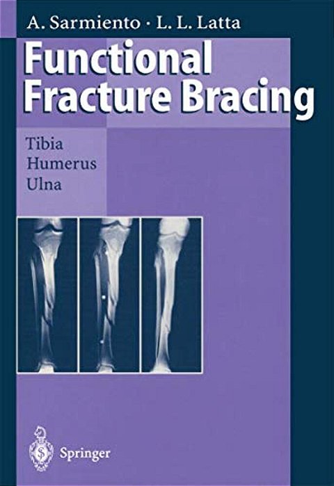 Functional Fracture Bracing: Tibia, Humerus, And Ulna-..