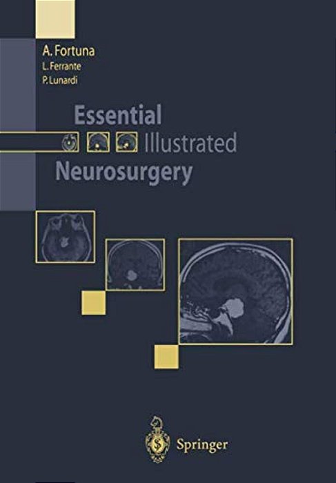 Essential Illustrated Neurosurgery-..