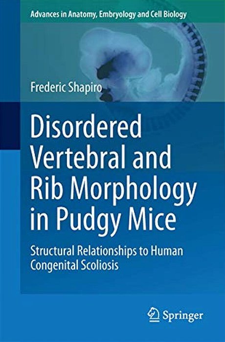 Disordered Vertebral And Rib Morphology In Pudgy Mice: Structural Relationships To Human Congenital Scoliosis-..