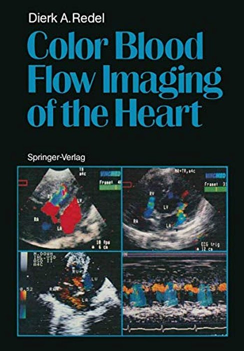 Color Blood Flow Imaging Of The Heart-..