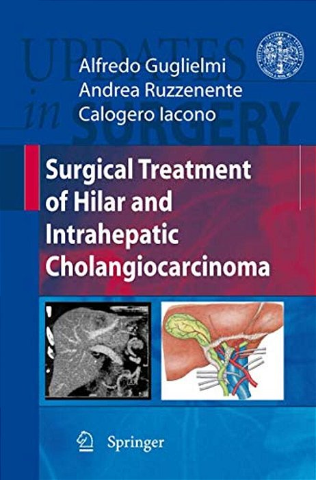 Surgical Treatment Of Hilar And Intrahepatic Cholangiocarcinoma-..