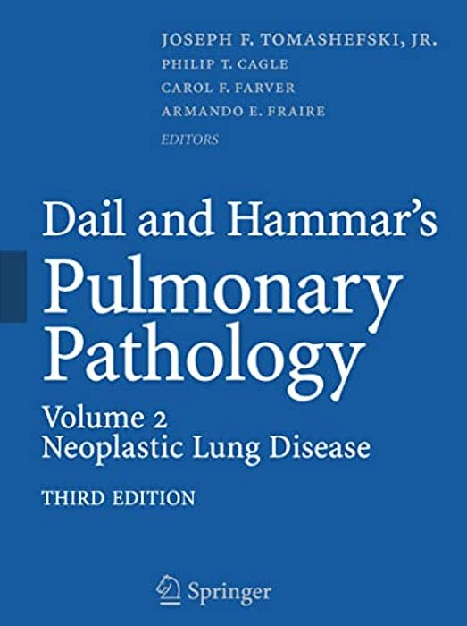 Dail And Hammar's Pulmonary Pathology: Volume II: Neoplastic Lung Disease-..