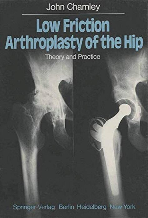 Low Friction Arthroplasty Of The Hip: Theory And Practice-..