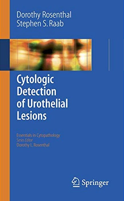 Cytologic Detection Of Urothelial Lesions-..