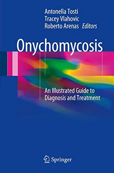 Onychomycosis: An Illustrated Guide To Diagnosis And Treatment-..