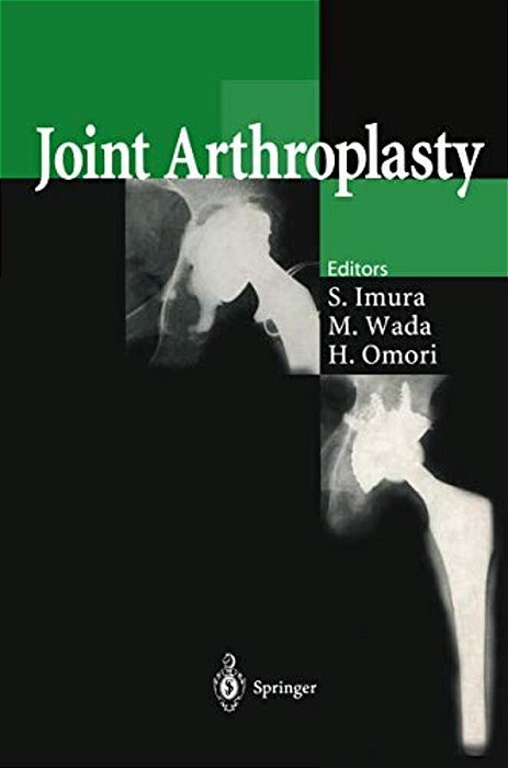 Joint Arthroplasty-..