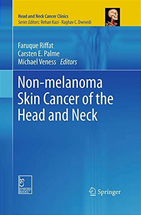Non-Melanoma Skin Cancer Of The Head And Neck-..