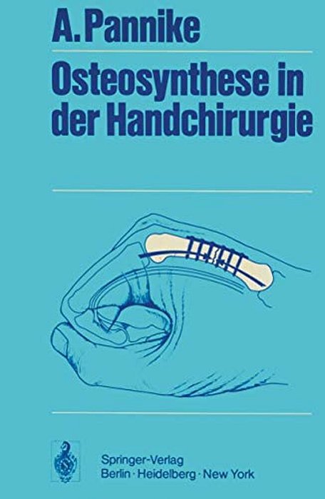 Osteosynthese In Der Handchirurgie-..