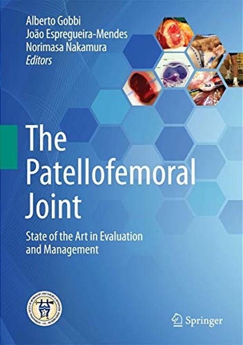 The Patellofemoral Joint: State Of The Art In Evaluation And Management-..