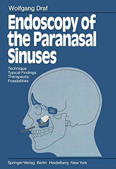 Endoscopy Of The Paranasal Sinuses: Technique - Typical Findings Therapeutic Possibilities-..