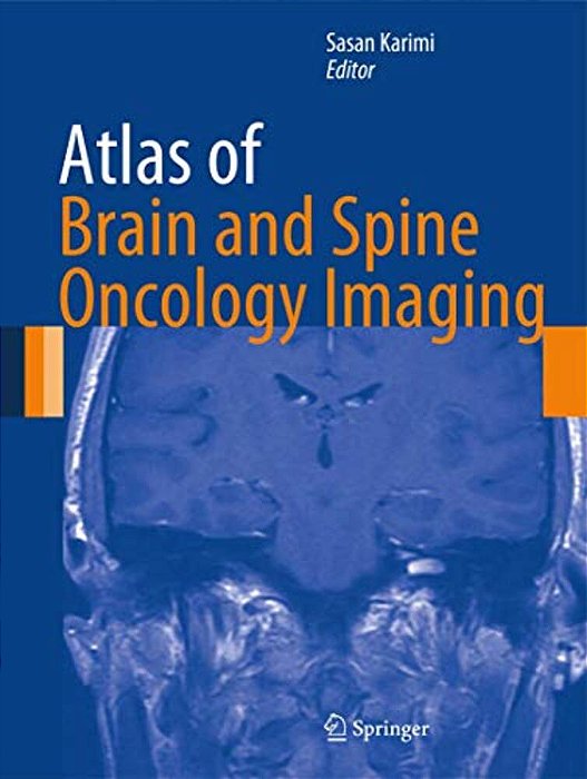 Atlas Of Brain And Spine Oncology Imaging-..