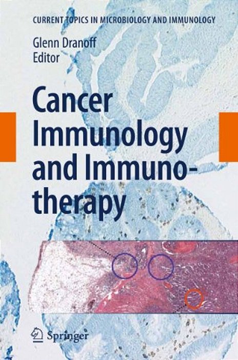 Cancer Immunology And Immunotherapy-..