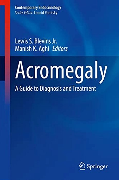 Acromegaly: A Guide To Diagnosis And Treatment-..